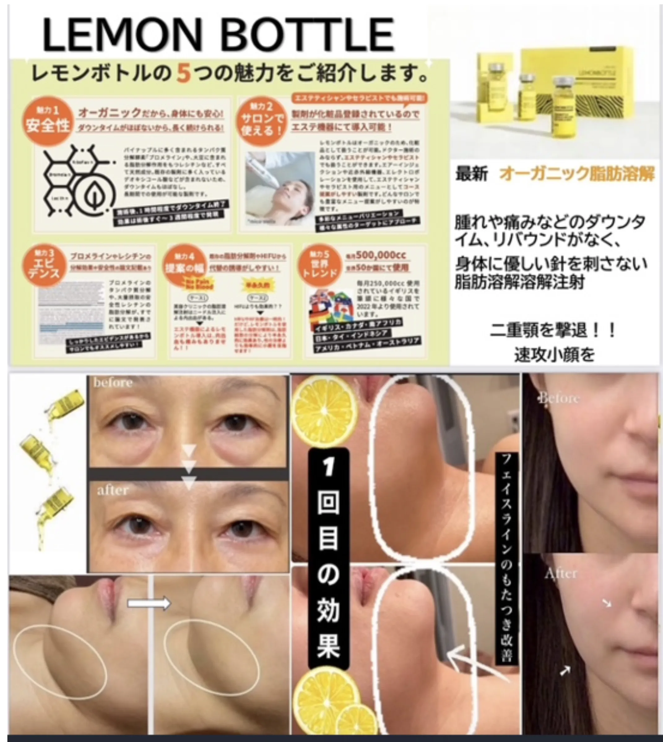メディア